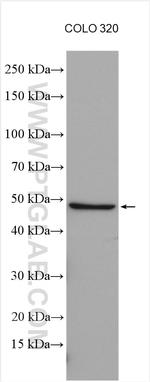 Biglycan Antibody in Western Blot (WB)