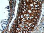 Biglycan Antibody in Immunohistochemistry (Paraffin) (IHC (P))