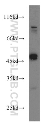 Biglycan Antibody in Western Blot (WB)