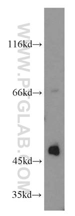 Biglycan Antibody in Western Blot (WB)