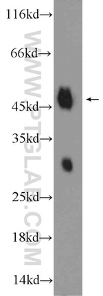 Biglycan Antibody in Western Blot (WB)