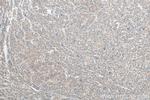 TYK2 Antibody in Immunohistochemistry (Paraffin) (IHC (P))