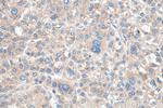 TYK2 Antibody in Immunohistochemistry (Paraffin) (IHC (P))