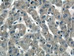 Antithrombin III Antibody in Immunohistochemistry (Paraffin) (IHC (P))