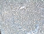 Antithrombin III Antibody in Immunohistochemistry (Paraffin) (IHC (P))