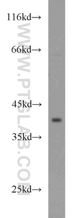 BCAT2 Antibody in Western Blot (WB)