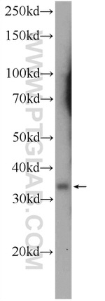 BCAT2 Antibody in Western Blot (WB)