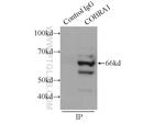 NELFB Antibody in Immunoprecipitation (IP)