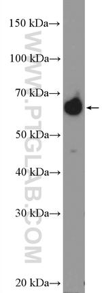 NELFB Antibody in Western Blot (WB)