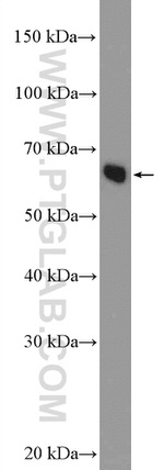 NELFB Antibody in Western Blot (WB)