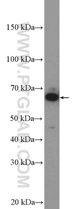 NELFB Antibody in Western Blot (WB)