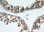 FUCA1 Antibody in Immunohistochemistry (Paraffin) (IHC (P))