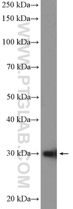 POLR3H Antibody in Western Blot (WB)