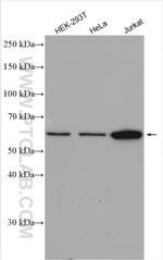 CHMP7 Antibody in Western Blot (WB)