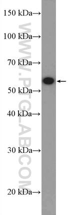CHMP7 Antibody in Western Blot (WB)