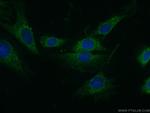 PAN2 Antibody in Immunocytochemistry (ICC/IF)