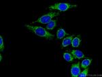 DLD Antibody in Immunocytochemistry (ICC/IF)