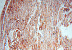 DLD Antibody in Immunohistochemistry (Paraffin) (IHC (P))