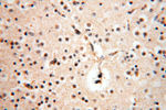 DLD Antibody in Immunohistochemistry (Paraffin) (IHC (P))