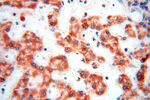 DLD Antibody in Immunohistochemistry (Paraffin) (IHC (P))