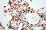 DLD Antibody in Immunohistochemistry (Paraffin) (IHC (P))