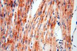 DLD Antibody in Immunohistochemistry (Paraffin) (IHC (P))