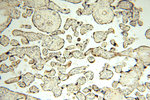 DLD Antibody in Immunohistochemistry (Paraffin) (IHC (P))