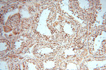 DLD Antibody in Immunohistochemistry (Paraffin) (IHC (P))