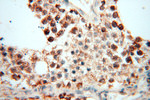 DLD Antibody in Immunohistochemistry (Paraffin) (IHC (P))