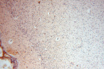 DLD Antibody in Immunohistochemistry (Paraffin) (IHC (P))