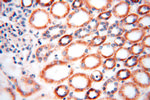 DLD Antibody in Immunohistochemistry (Paraffin) (IHC (P))