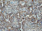 DLD Antibody in Immunohistochemistry (Paraffin) (IHC (P))