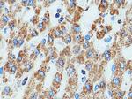 DLD Antibody in Immunohistochemistry (Paraffin) (IHC (P))