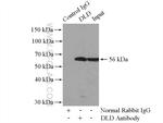 DLD Antibody in Immunoprecipitation (IP)