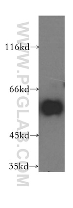 DLD Antibody in Western Blot (WB)