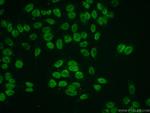 Histone H2A.z Antibody in Immunocytochemistry (ICC/IF)