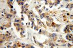 ST6GALNAC5 Antibody in Immunohistochemistry (Paraffin) (IHC (P))