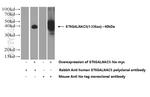 ST6GALNAC5 Antibody in Western Blot (WB)