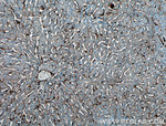 Caveolin-1 Antibody in Immunohistochemistry (Paraffin) (IHC (P))