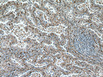 Caveolin-1 Antibody in Immunohistochemistry (Paraffin) (IHC (P))