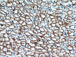 Caveolin-1 Antibody in Immunohistochemistry (Paraffin) (IHC (P))