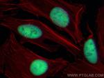 DEK Antibody in Immunocytochemistry (ICC/IF)