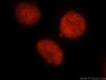 DEK Antibody in Immunocytochemistry (ICC/IF)