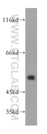 DEK Antibody in Western Blot (WB)