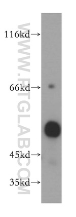 DEK Antibody in Western Blot (WB)