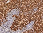 Aldo-keto Reductase Family 1 Member C1/DD1 Antibody in Immunohistochemistry (Paraffin) (IHC (P))