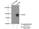 MCM8 Antibody in Immunoprecipitation (IP)