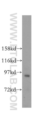 MCM8 Antibody in Western Blot (WB)