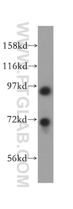 MCM8 Antibody in Western Blot (WB)