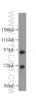 MCM8 Antibody in Western Blot (WB)